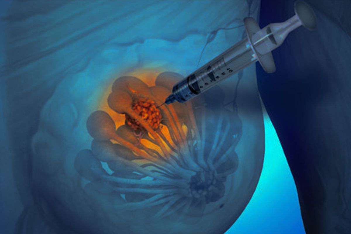 Are needle biopsies safe?