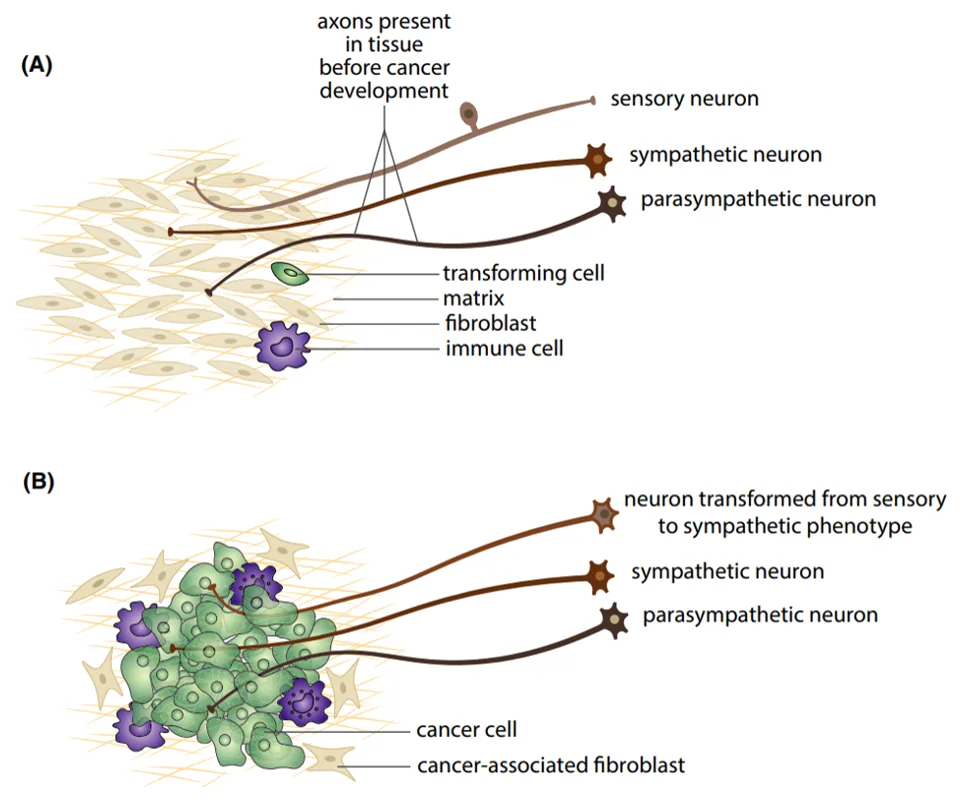 Adrenergic neuronal transformation in cancer cells Figure 1