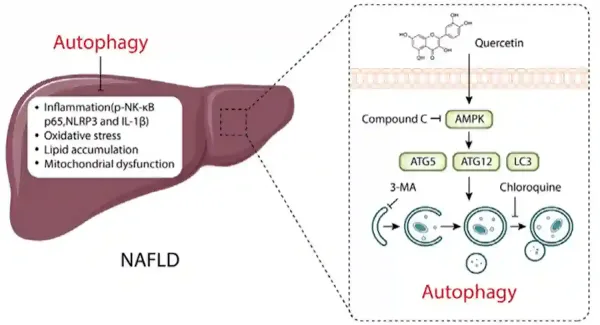 Figure 3. Molecular mechanism of quercetin in treating non-alcoholic fatty liver disease (NAFLD)