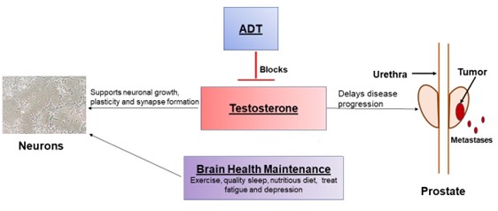 Figure 2. The impact of androgen deprivation therapy (ADT) on prostate cancer and brain health.