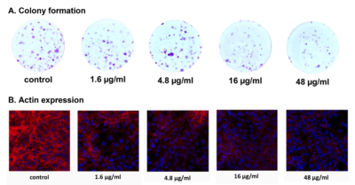 Figure 3. Effects of curcumin on verbal memory, as measured by consistent long-term recall (Buschke CTLR).