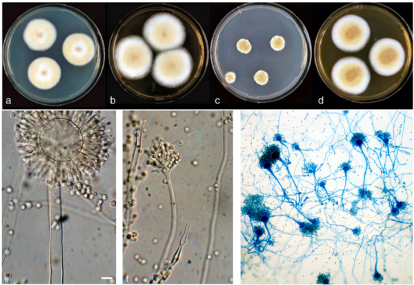 Abbildung 2 . Morphologie von Aspergillus- Arten bei verschiedenen Visualisierungstechniken.