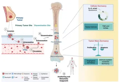 A few breast cancer cells can escape the original Figure 1. tumour, enter the bloodstream and travel to distant organs such as the bone marrow