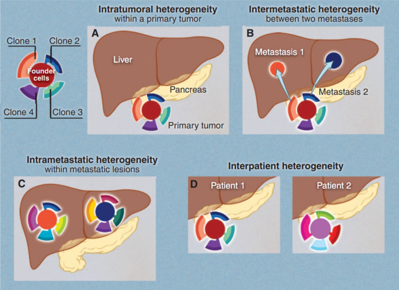 Figure 2. Tumour heterogeneity across space and patients. Pancreatic cancer with liver metastasis is used as an example.