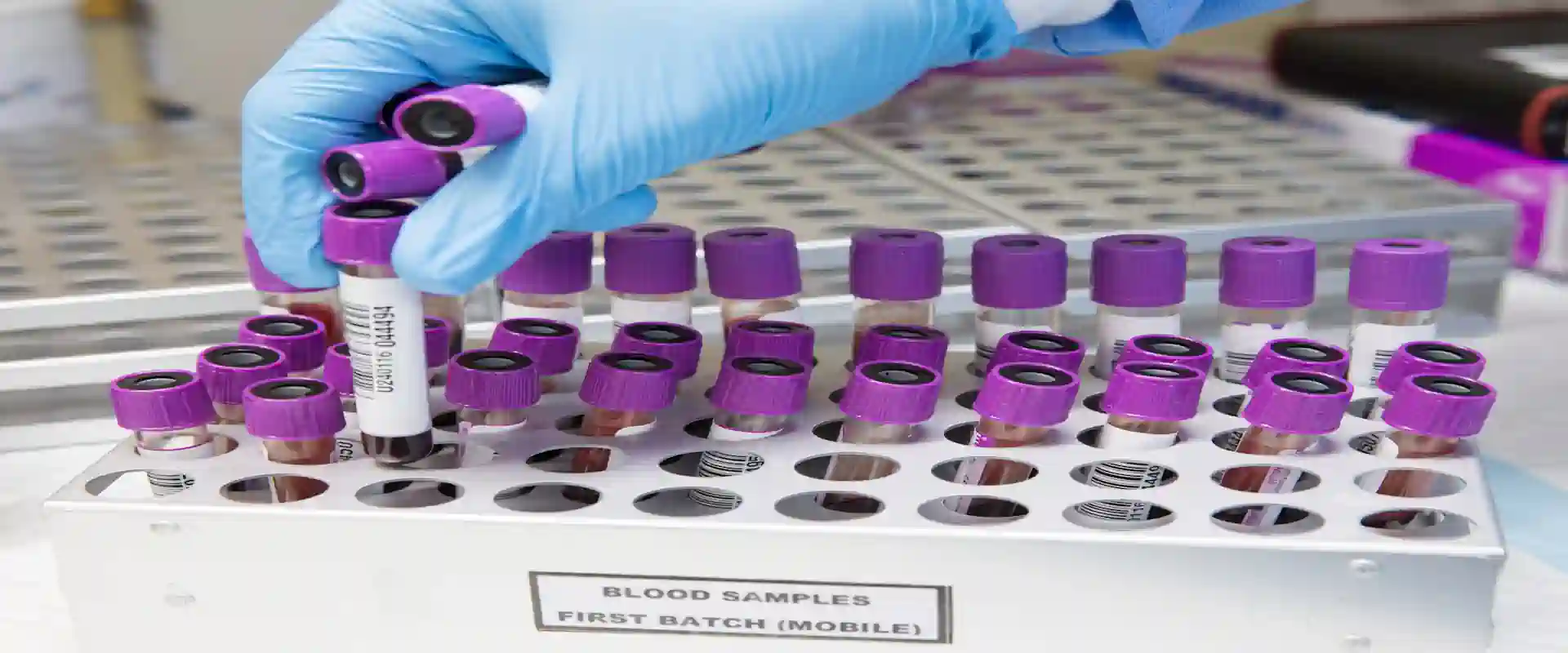 : Blood sample tube in a laboratory representing liquid biopsy and cancer detection through a blood test